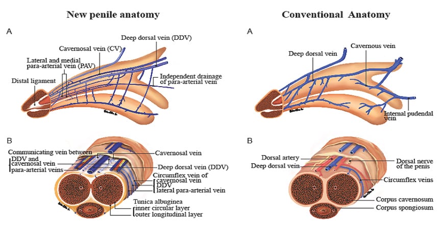 Esquema de la anatomía del pene nueva y convencional.